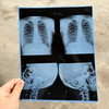 210 Micron Medical Inkjet Blue X-Ray Film PET Roll for Medical Imaging