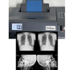 Blue Inkjet Medical X-Ray Film PET for CT, DR & MRI 
