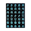 Medical Thermal Blue X-Ray Film for Digital Medical Dry Imaging