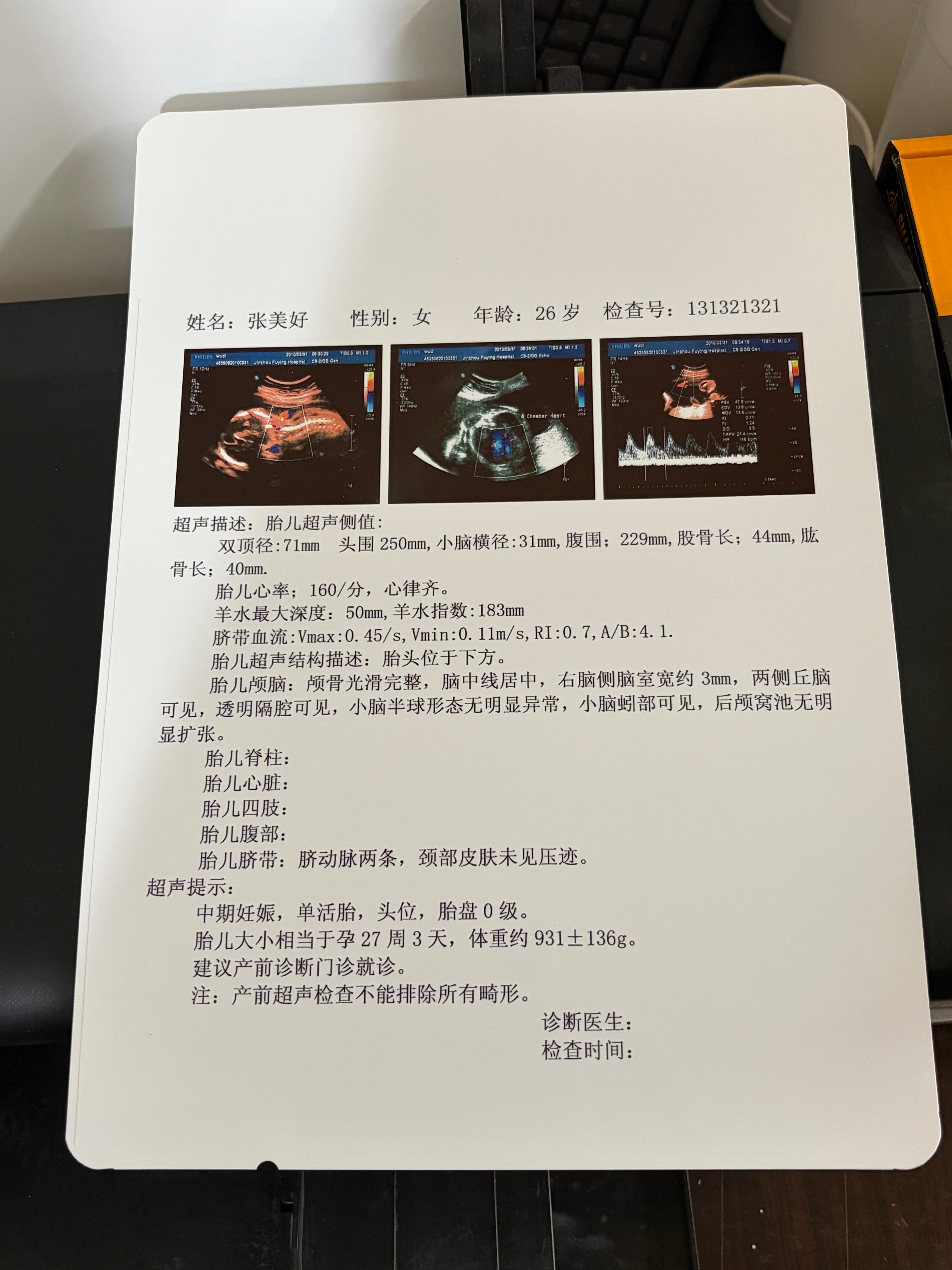 Medical Inkjet White X-Ray Film for Ultrasound, CT & Medical Imaging