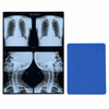 175mic medical blue base inkjet radiology film